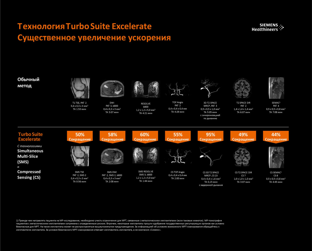С помощью технологии Turbo Suite вы можете ускорить весь процесс МРТ-исследования до 50 % для всех контрастов, ориентаций и участков тела. 
